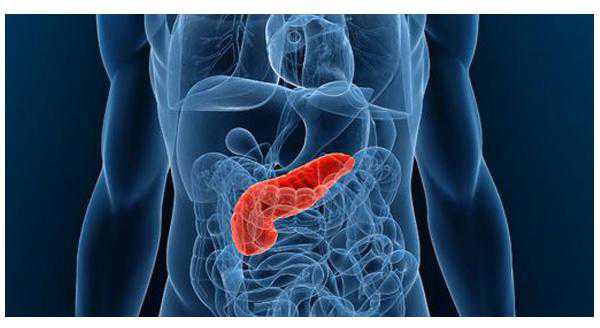 What Causes Pancreatic Cancer?